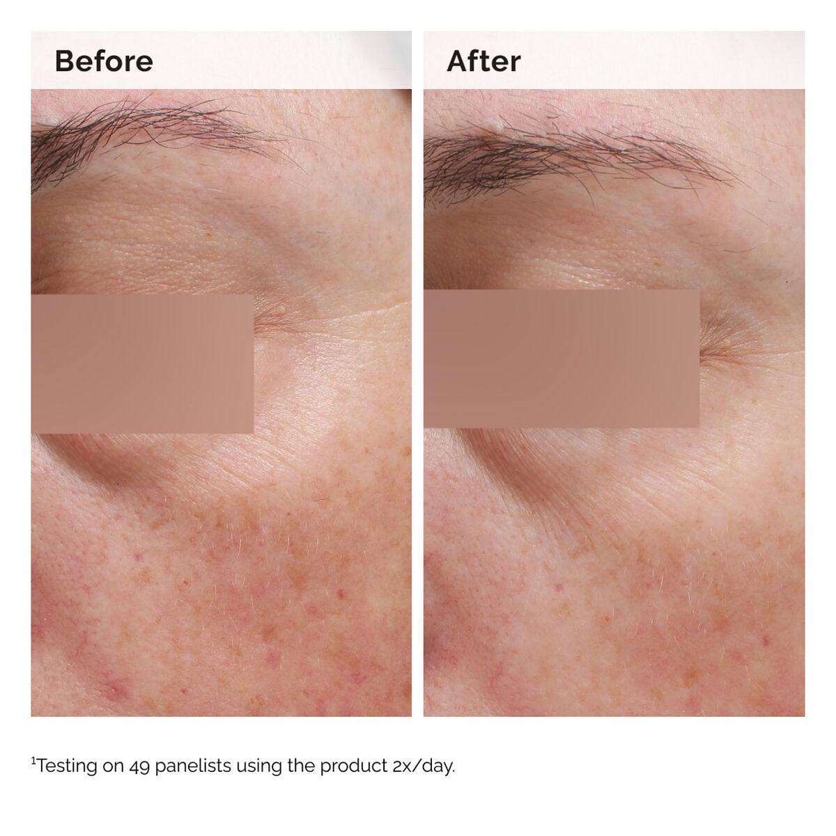 niacinamide-5-face-and-body-emulsion-y4 2024-08-23-ORD-Nia-5pct-Face-Body-B-A-Elasticity-Global-02-1x1.jpg