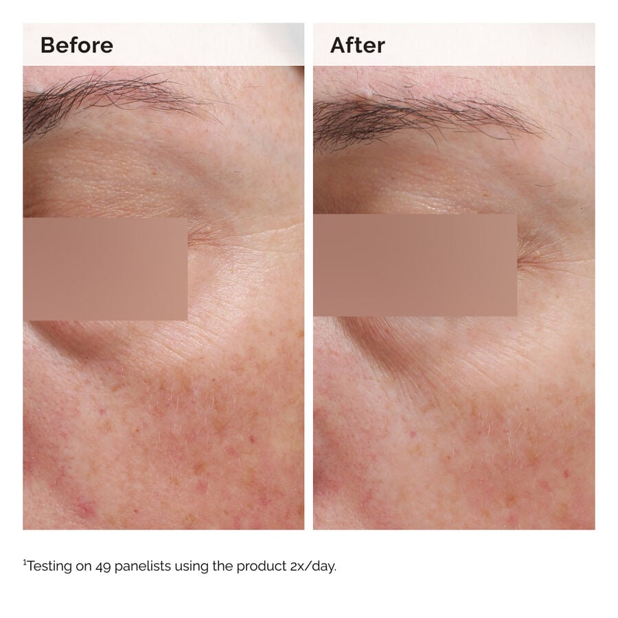 niacinamide-5-face-and-body-emulsion-y4 2024-08-23-ORD-Nia-5pct-Face-Body-B-A-Elasticity-Global-02-1x1.jpg