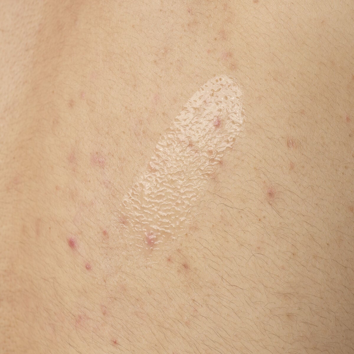 salicylic-acid-0-5-body-serum-c3 ORD-salicylic-acid-05-body-240ml-application.jpg