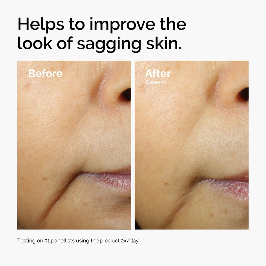 caffeine-3-escin-1-face-serum-y8 ord-caffeine-3pct-escin-1pct-face-serum-before-after-sagging.jpg