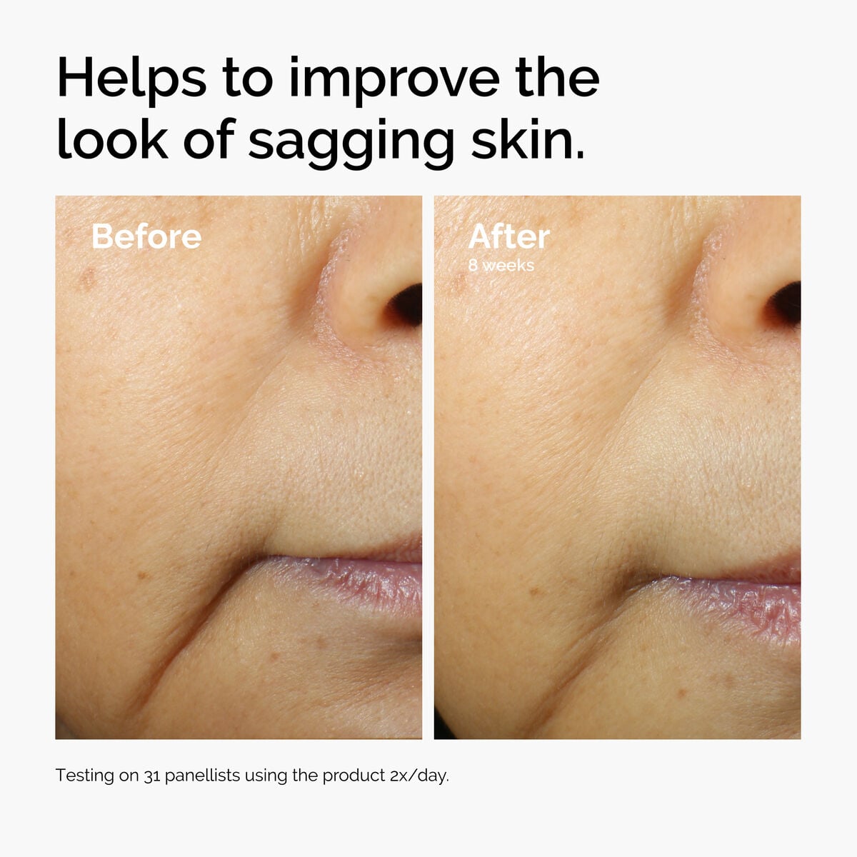 caffeine-3-escin-1-face-serum-y8 ord-caffeine-3pct-escin-1pct-face-serum-before-after-sagging.jpg