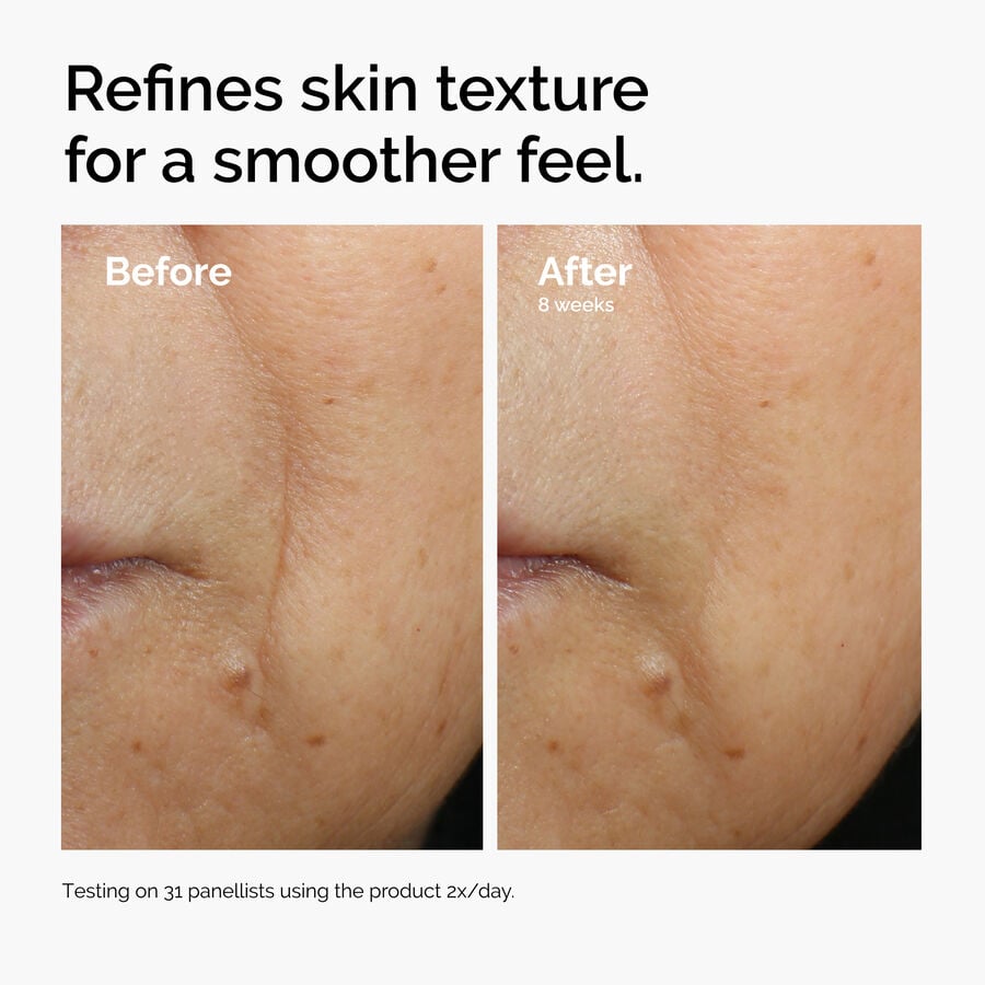 caffeine-3-escin-1-face-serum-y8 ord-caffeine-3pct-escin-1pct-face-serum-before-after-texture.jpg