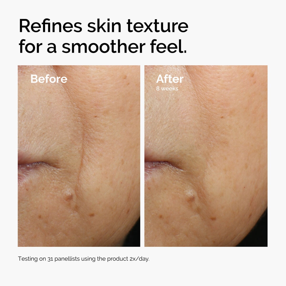 caffeine-3-escin-1-face-serum-y8 ord-caffeine-3pct-escin-1pct-face-serum-before-after-texture.jpg