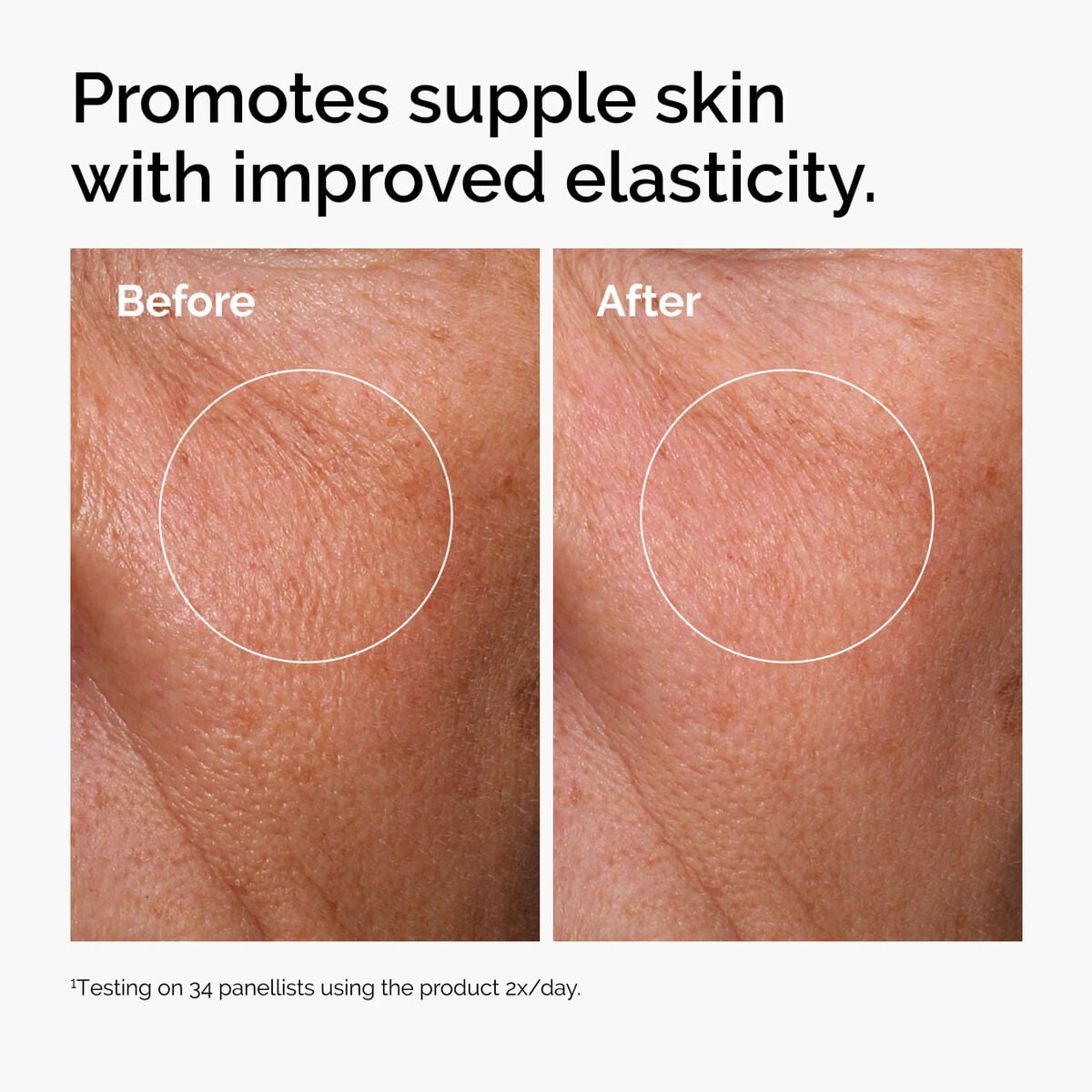 hyaluronic-acid-2-b5-with-ceramides-s0 ord-hyaluronic-acid-2pct-b5-hydrating-serum-before-after-elasticity.jpg