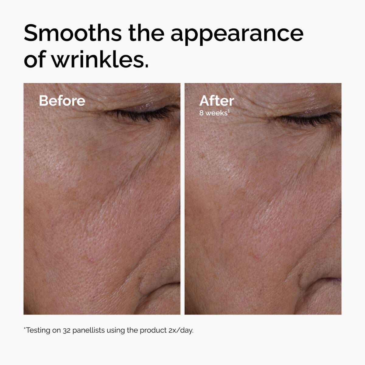 multi-peptide-ha-serum-q2 ord-multi-peptide-ha-serum-wrinkles-before-after.jpg