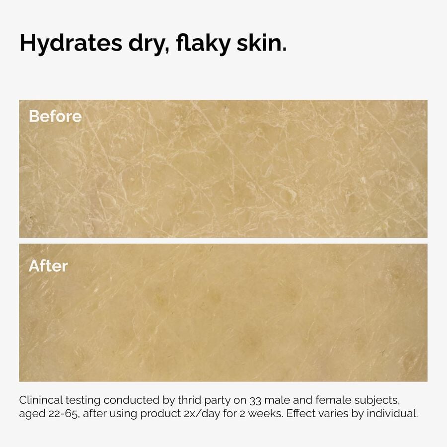 the-body-care-collection-n1 ord-natural-moisturizing-factors-inulin-body-before-after-graphic-02.jpg
