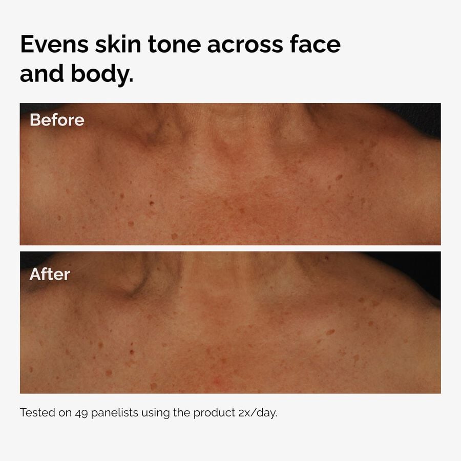the-body-care-collection-n1 ord-niacinamide-face-body-serum-before-after-even-tone-graphic.jpg