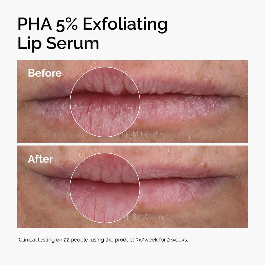 pha-5-exfoliating-lip-serum-b7 ord-pha-5pct-lip-exfoliating-serum-before-after.jpg