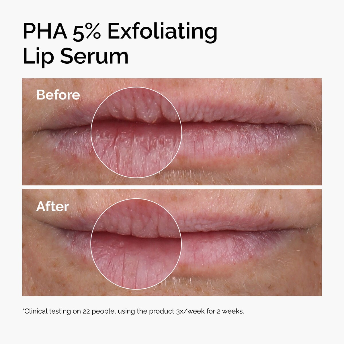 pha-5-exfoliating-lip-serum-b7 ord-pha-5pct-lip-exfoliating-serum-before-after.jpg