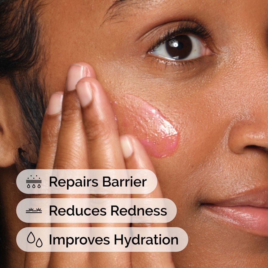 soothing-and-barrier-support-serum-g5 ord-soothing-barrier-support-serum-model-application-with-benefits.jpg