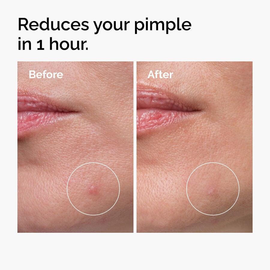sulfur-10-powder-to-cream-concentrate-n8 ord-sulfur-10pct-powder-to-cream-concentrate-before-after-NA.jpg